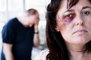 Woman with black eye and man standing in background