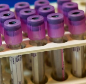 Test tubes for blood samples