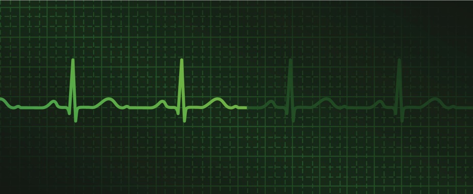 heart monitor