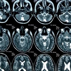 xray brain scan imaging