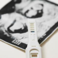pregnancy test and ultrasound